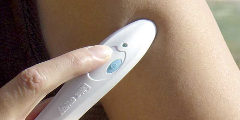 Cómo acabar con las picaduras de mosquitos utilizando un bolígrafo