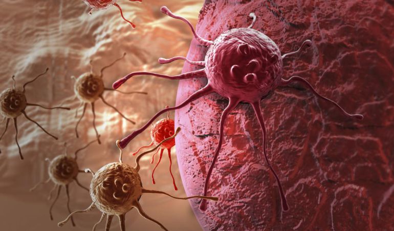 Detectan proceso molecular que desencadena la metástasis del cáncer