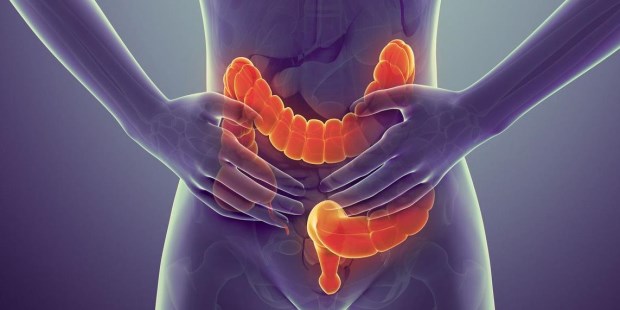 Detectado a tiempo, el cáncer de colon tiene cura.