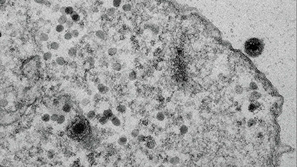 Yaravirus: un virus con genes totalmente desconocidos para la ciencia
