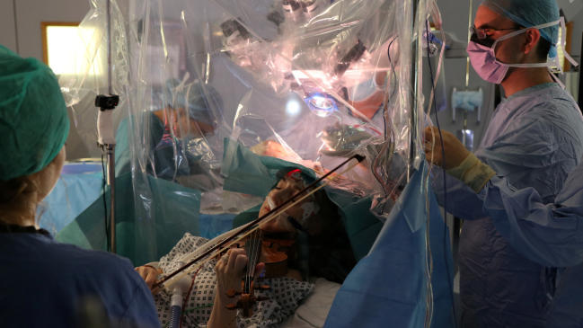 Violinista tocó durante operación en su cerebro, para no perder su talento