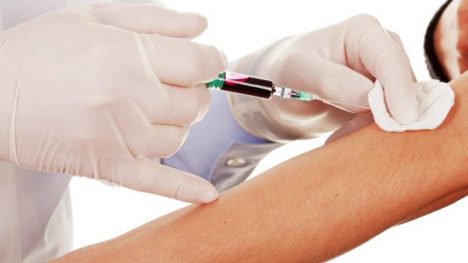 Covid-19: Hematología muestra el deterioro del sistema inmunológico