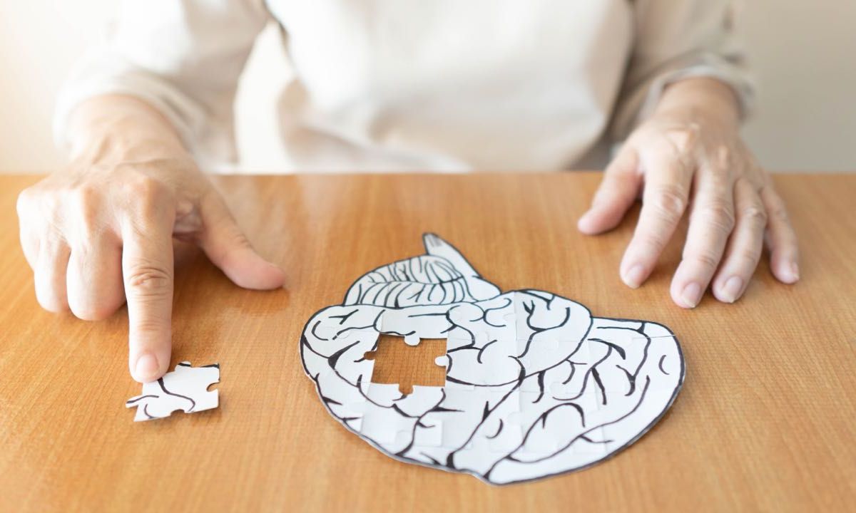Alzheimer