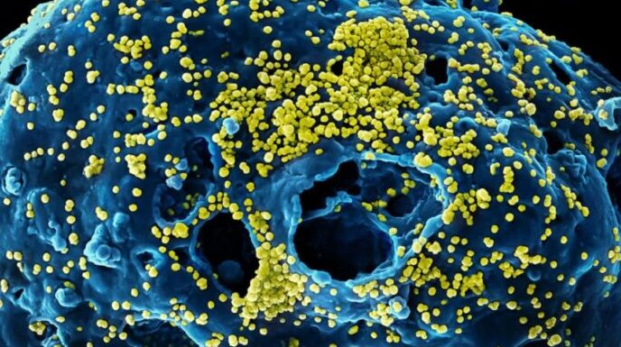 Covid-19: Así deforma y destruye a las células humanas el coronavirus