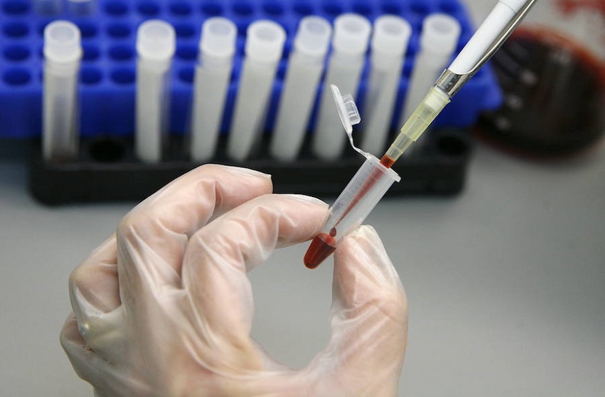 Salud: Nuevo agente antirretroviral de larga duración para tratar el VIH