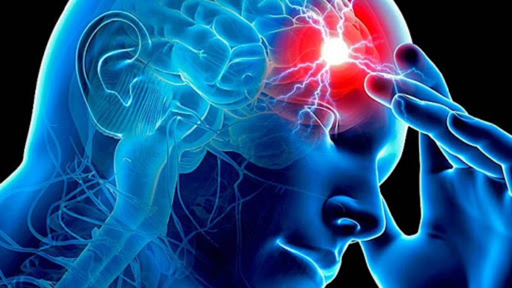 Derrame cerebral: La piel y los ojos podrían avisarte algún posible riesgo