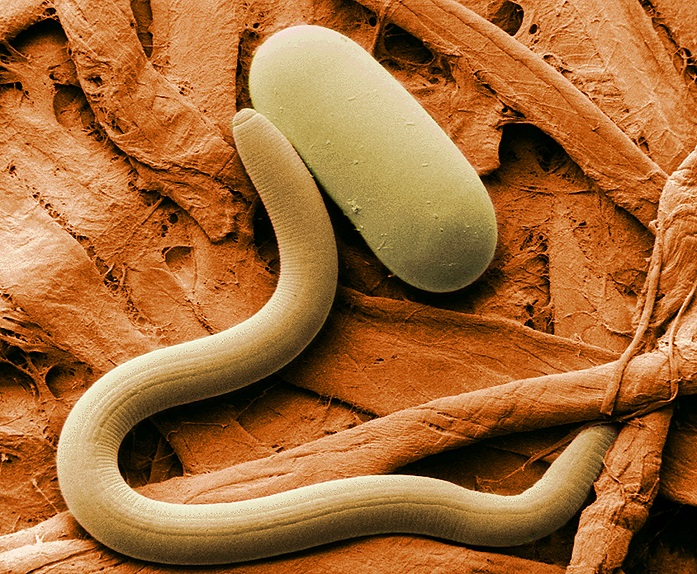 Estudio advierte la posibilidad que nuevos nematodos infecten a humanos