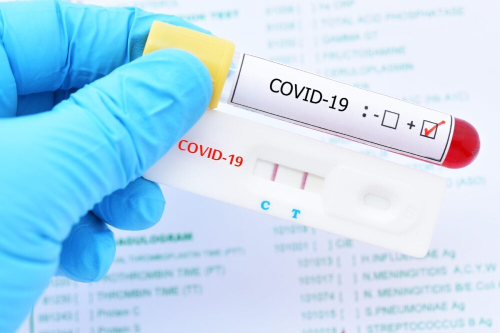 PCR