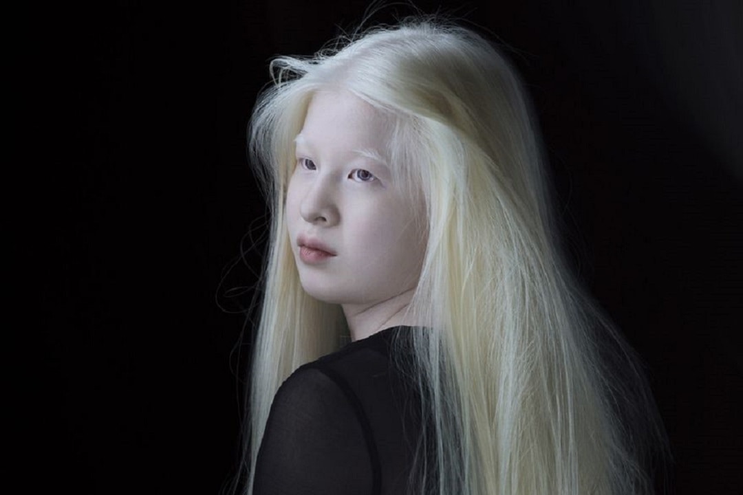 Xueli, la niña albina abandonada en China, es ahora modelo de Vogue