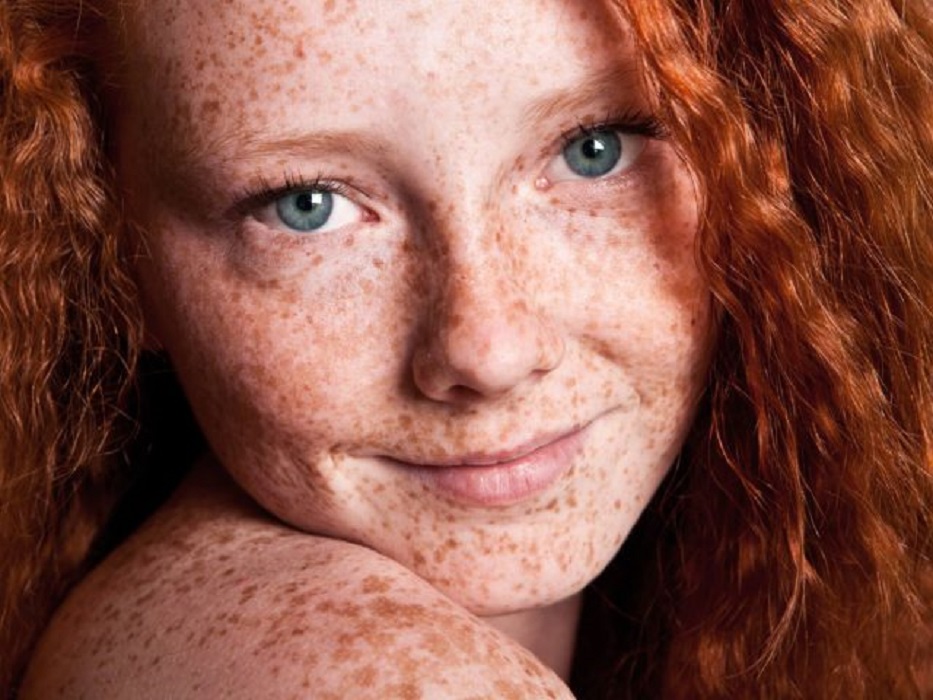 Conoce por qué los pelirrojos soportan mejor el dolor