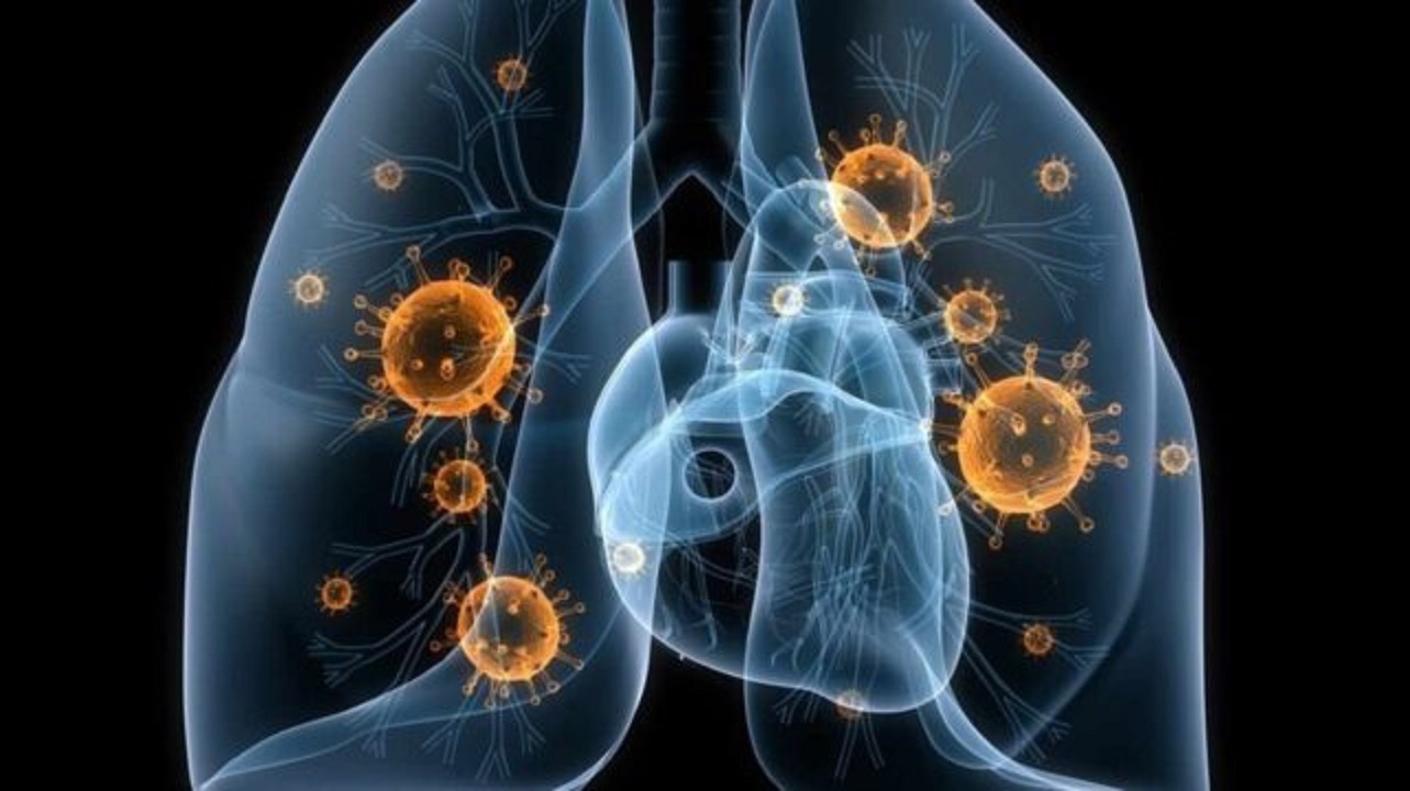 Medicina personalizada ¿Se puede aplicar al cáncer de pulmón?