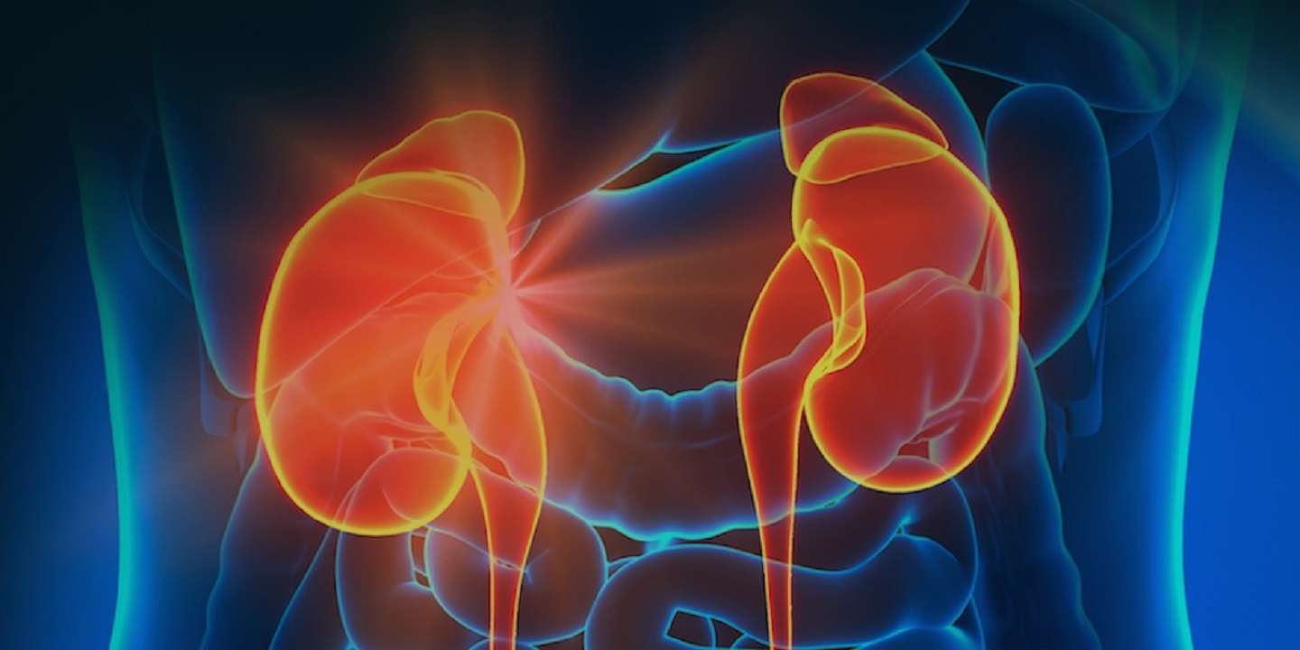 Pielonefritis: conoce los síntomas, causas y tratamiento