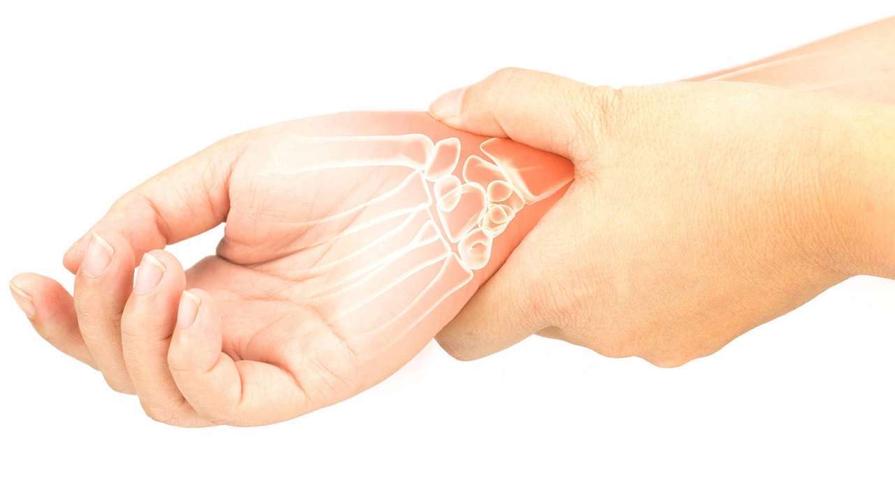 Artritis reumatoide: síntomas y características de esta enfermedad