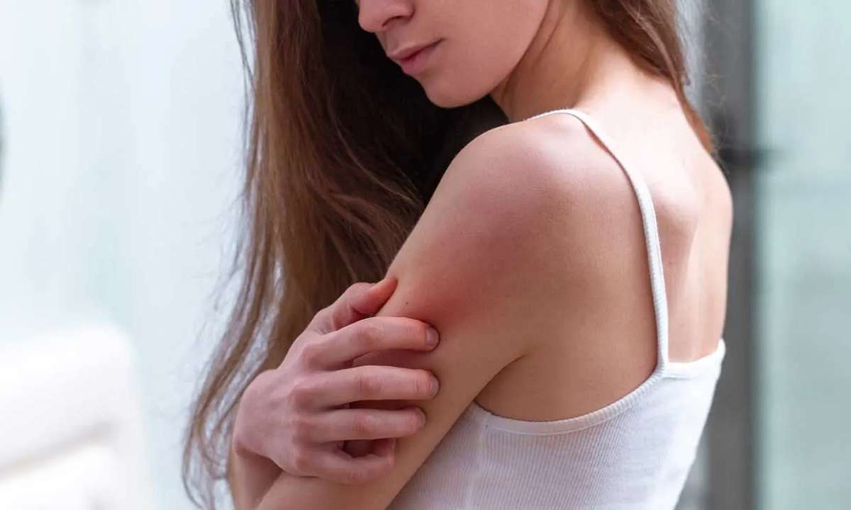 Enfermedades de la piel: conoce qué es, sus síntomas y causas