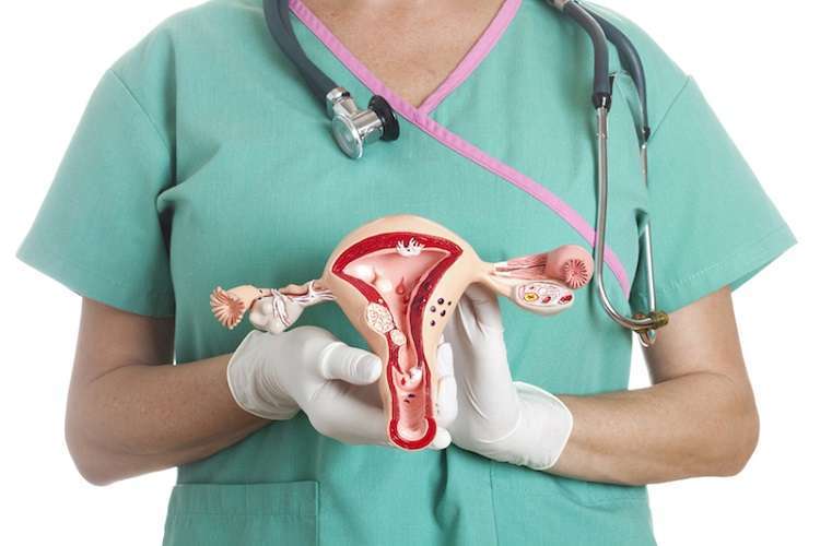Fibromas uterinos