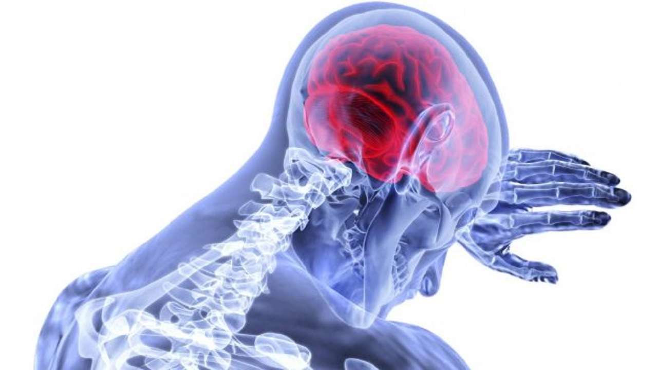 Ictus: trastorno súbito de la circulación cerebral