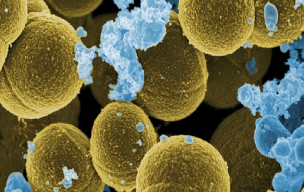 Superbacterias