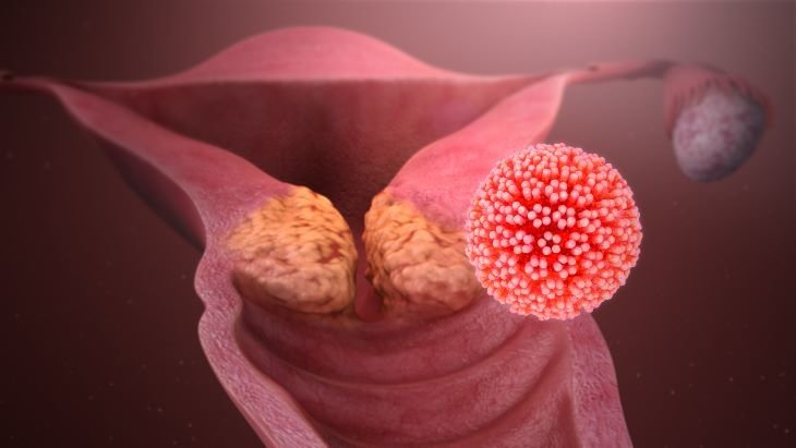 Cáncer
