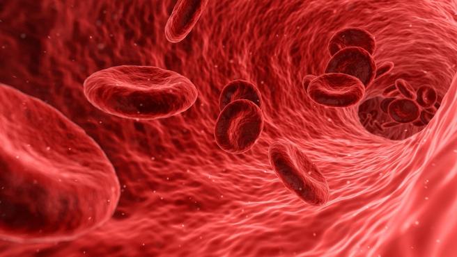 Anemia