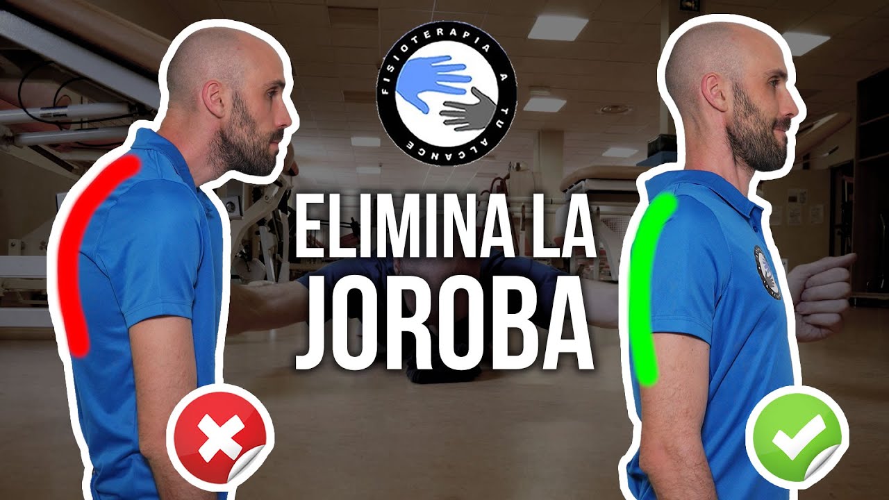 Como quitar la joroba