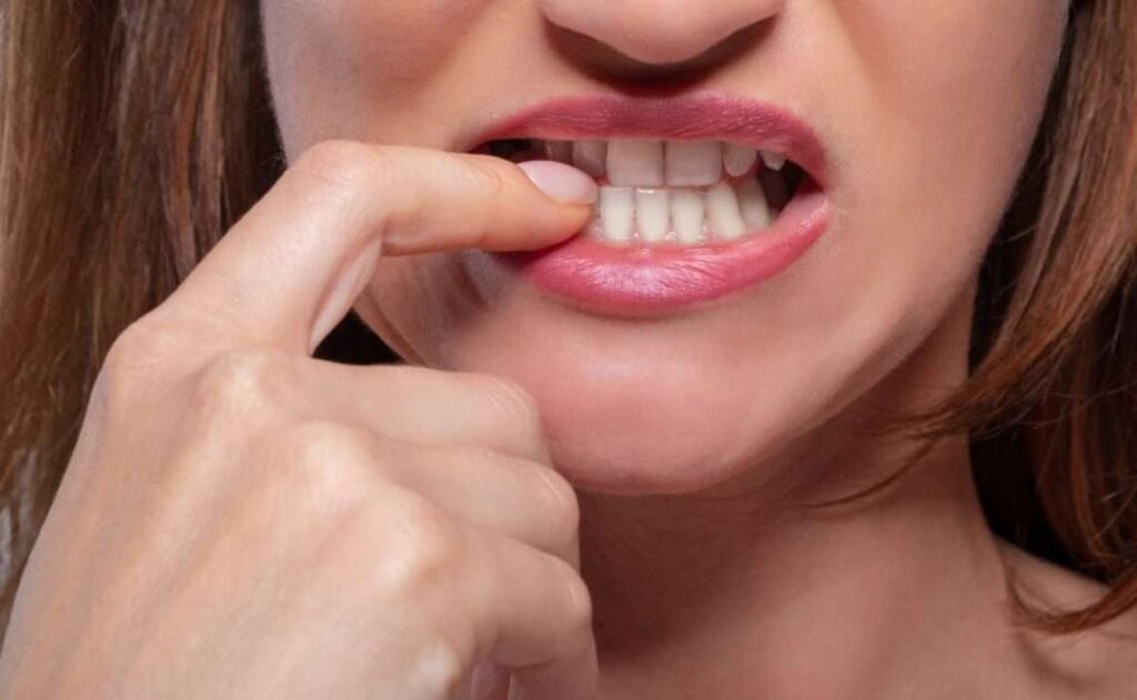 Morderse las uñas