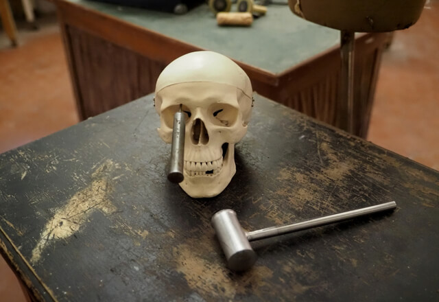 Técnica de la lobotomía