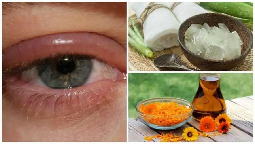infecciones en los ojos