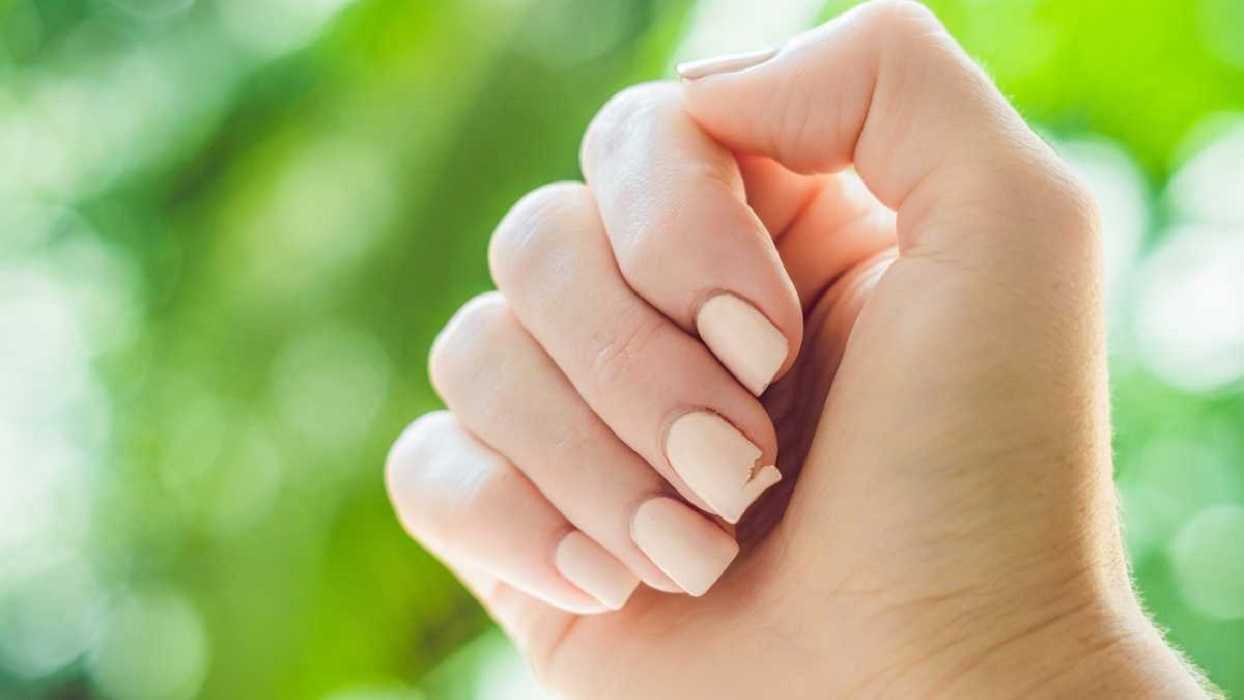 Uñas quebradizas: fortalecelas con estas vitaminas y mantenlas fuertes