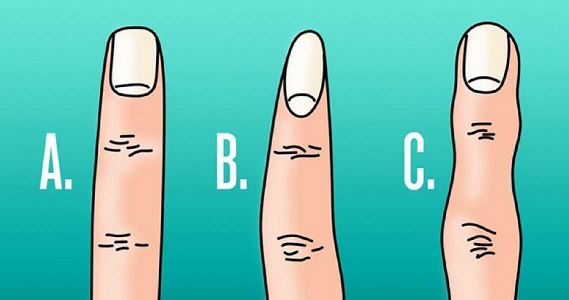 Test viral: ¿De qué forma son tus dedos? entérate de tu lado oculto