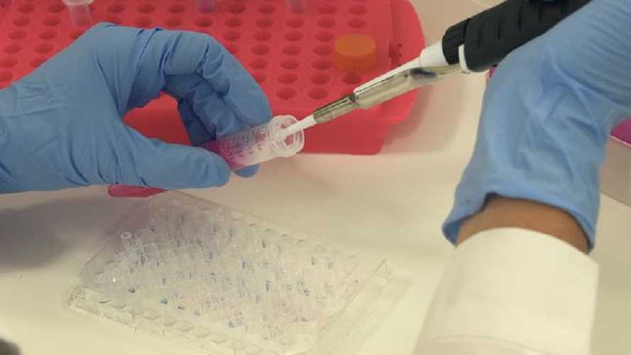 Cáncer de colon en jóvenes