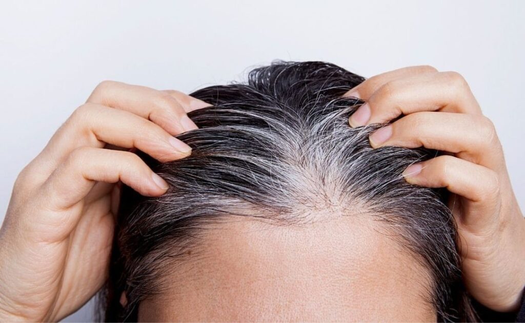el origen de las canas