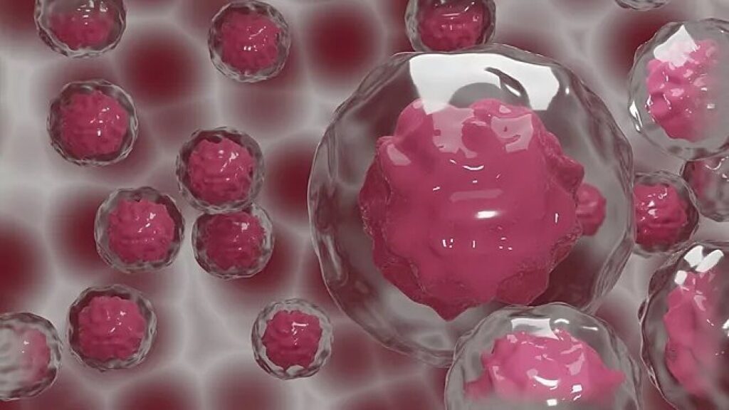 Dostarlimab vs. cáncer colorrectal