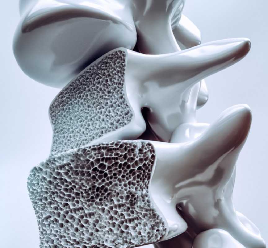 Densidad ósea: medidas para evitar la pérdida en el día a día
