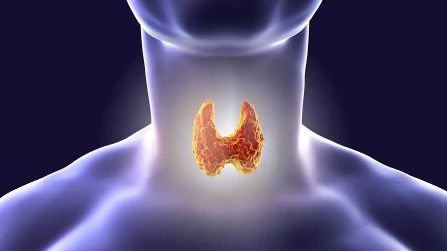 Cáncer de tiroides