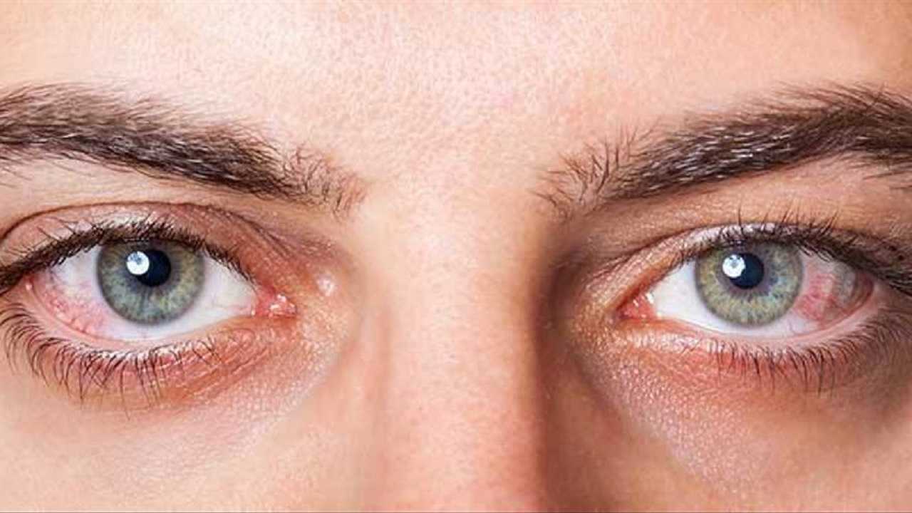 Diabetes: los problemas de visión asociados a esta enfermedad
