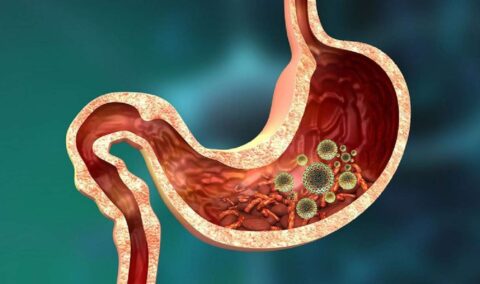 Cúrcuma para eliminar parásitos intestinales y gases