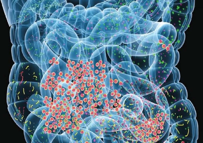 Trasplantes de microbiota fecal