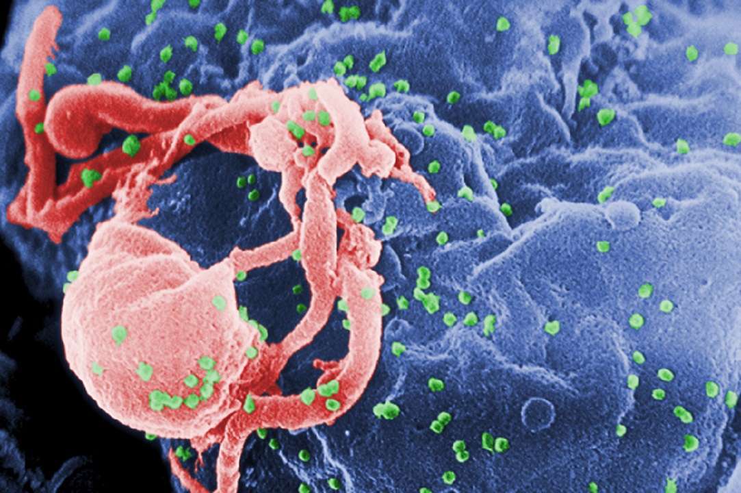 Sida: conoce cuál es el origen de esta enfermedad
