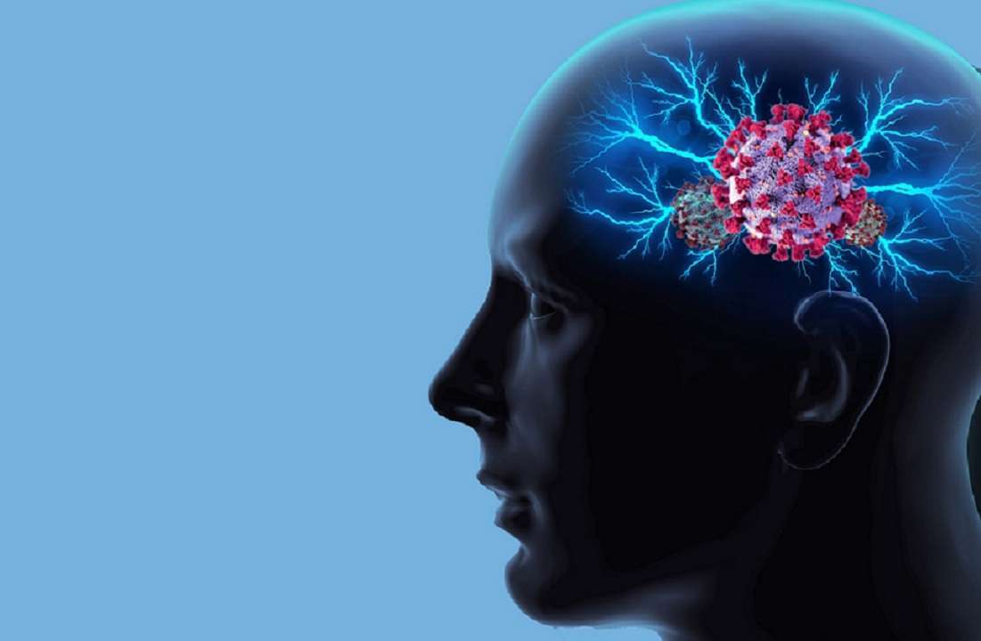 Niebla mental por covid: conoce lo que dicen los científicos