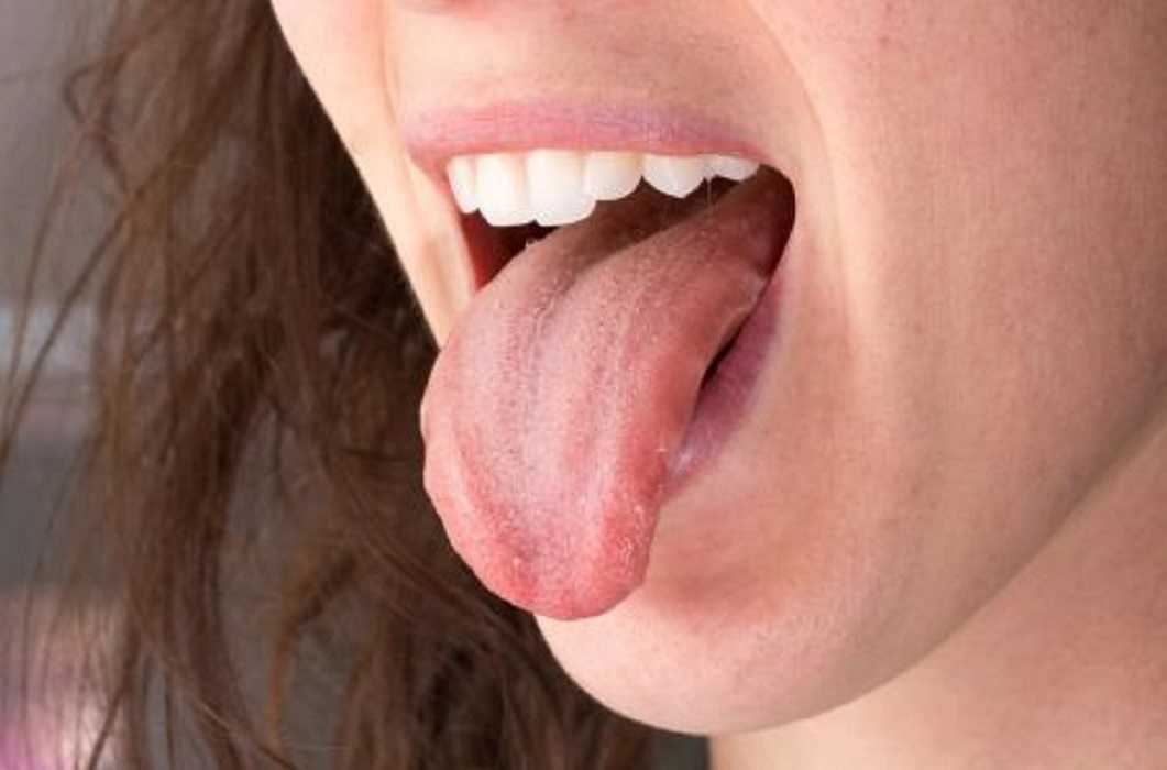 Sustancia blanquecina en la lengua: qué es y por qué aparece