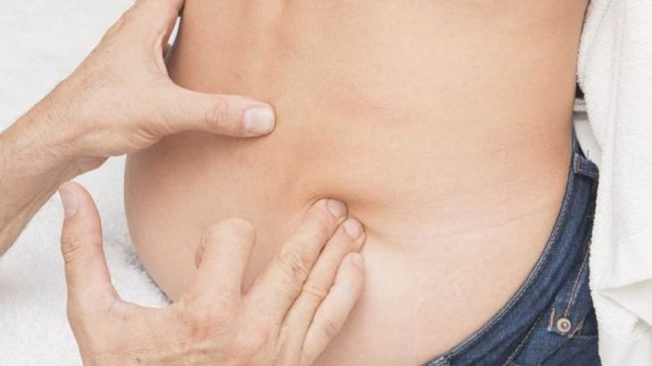 Peritonitis: conoce qué es, síntomas, causas y tratamiento