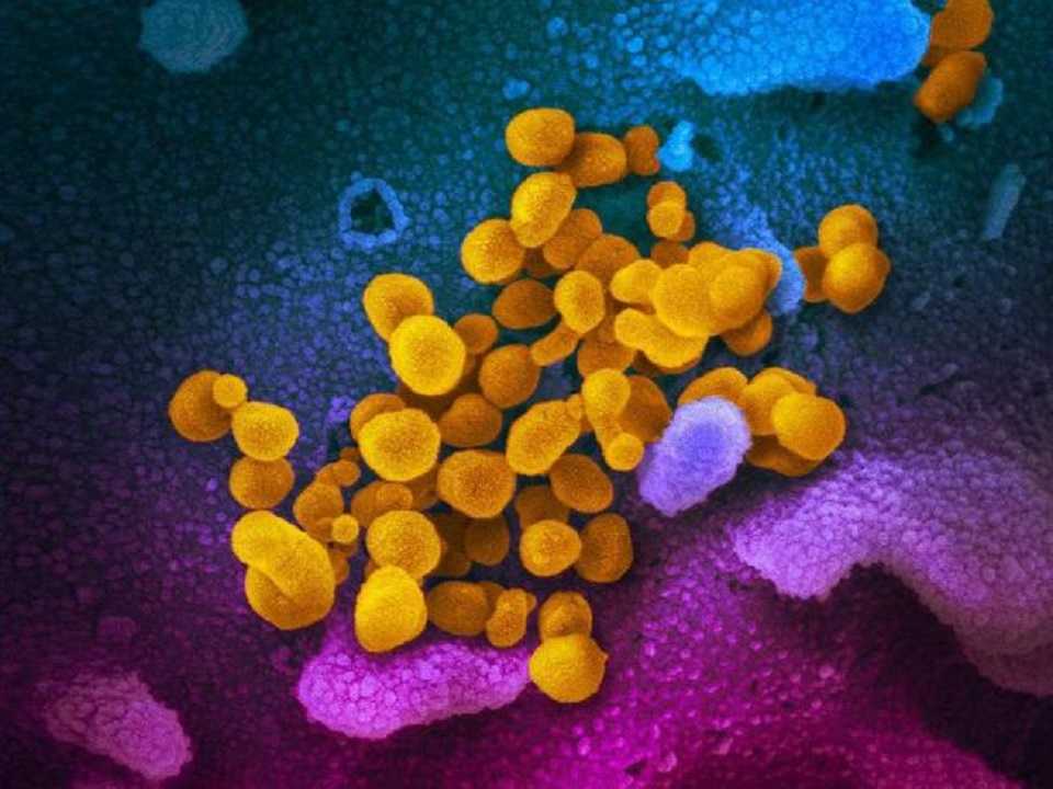 COVID larga: minúsculas señales revelan el misterio