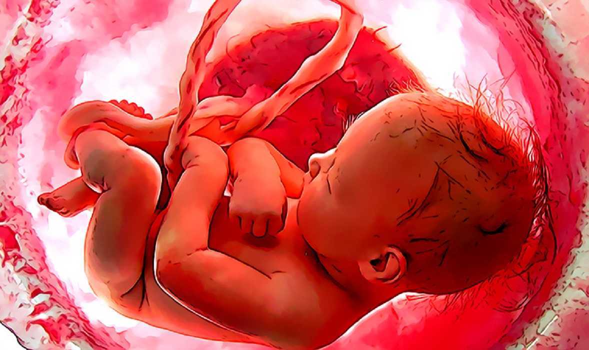 Extraen feto del cerebro de su hermana melliza