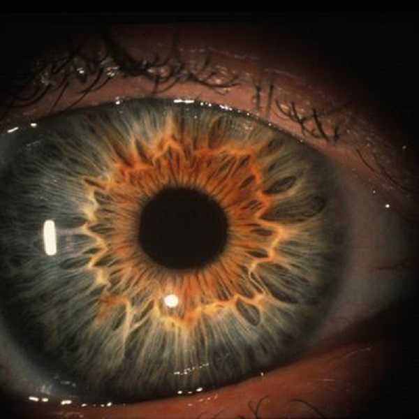 Por qué parpadeamos