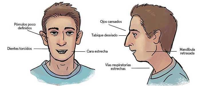 Respirar por la boca