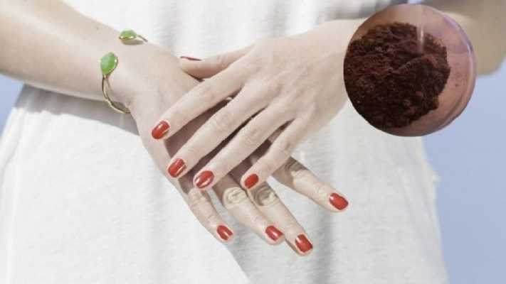 Manchas en las manos