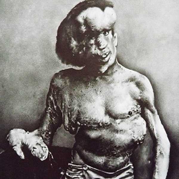 El hombre elefante | Relatos del lado oscuro