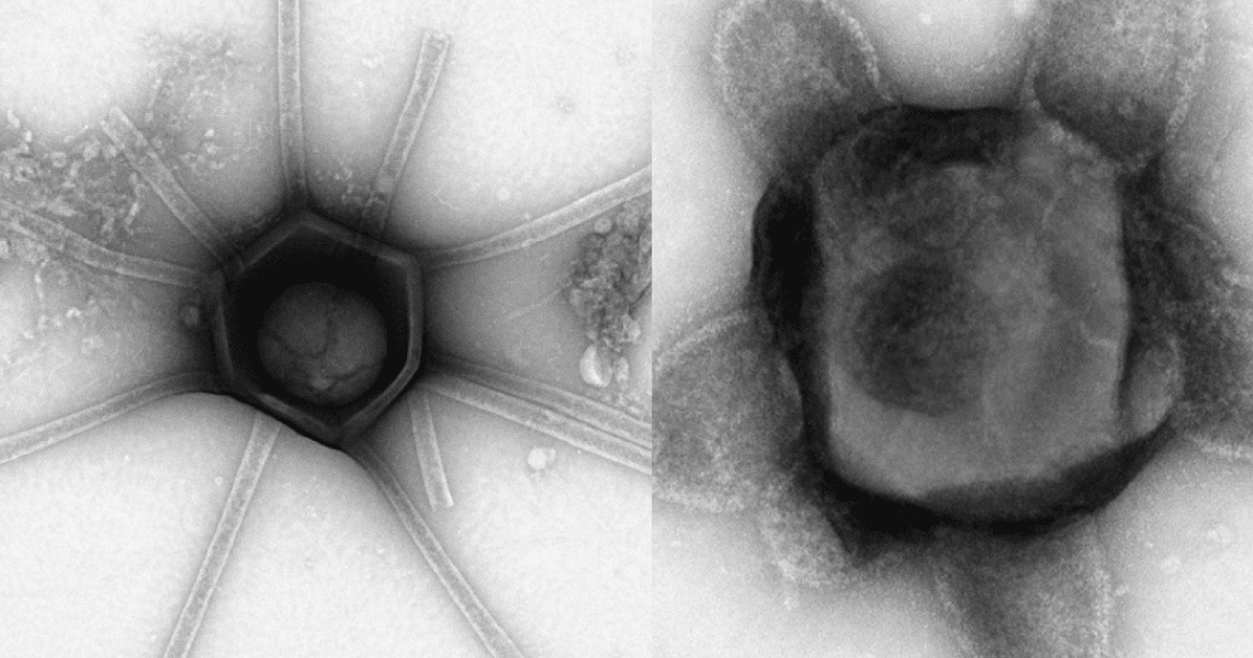 Gorgona: el virus hallado en los bosques de Massachusetts