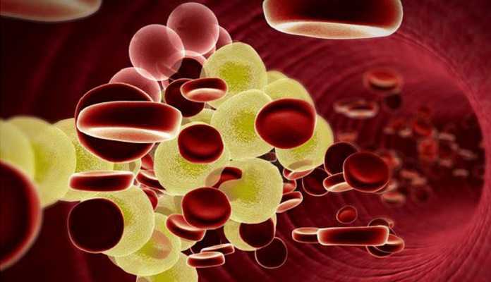 colesterol y triglicéridos altos