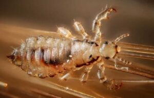 Los piojos nos han acompañado desde hace miles de años